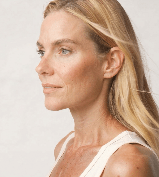 Imagen 2 Deep plan neck lift