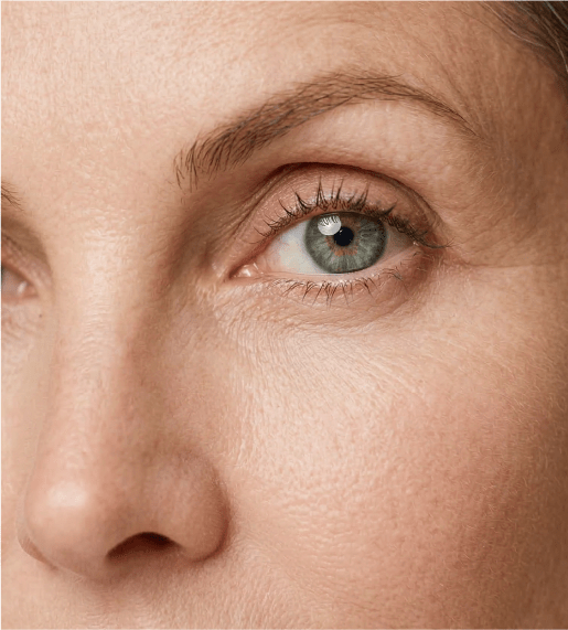 Imagen 2 Levantamiento de cejas
