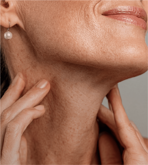 Imagen 2 Estiramiento de cuello