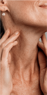 Imagen 2 Estiramiento facial movil_1