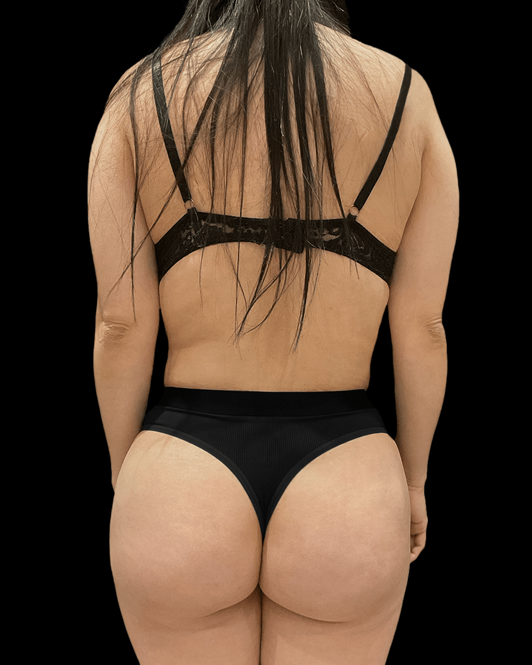 Antes y después de un BBL