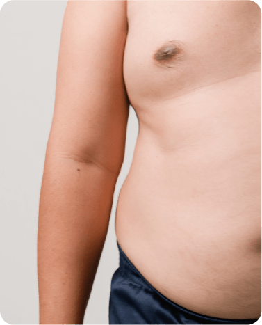 Ideal Weight Loss